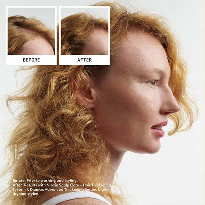 Nioxin System 1 Scalp Therapy Conditioner Liter