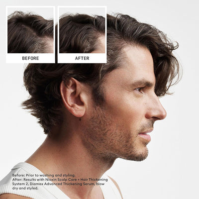 Nioxin System 2 Kit
