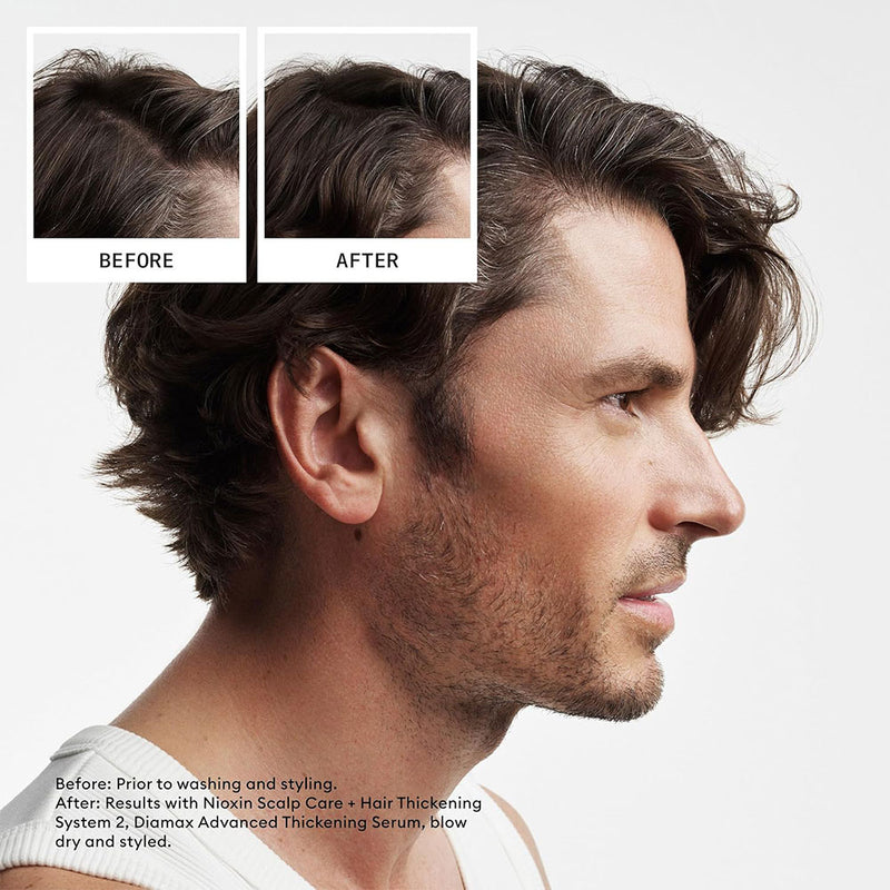 Nioxin System 2 Kit