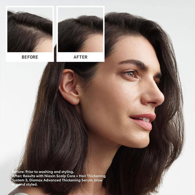Nioxin System 3 Kit