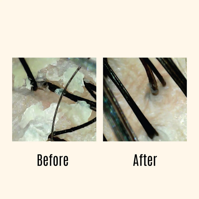 Malibu C Head Lab Intro Kit