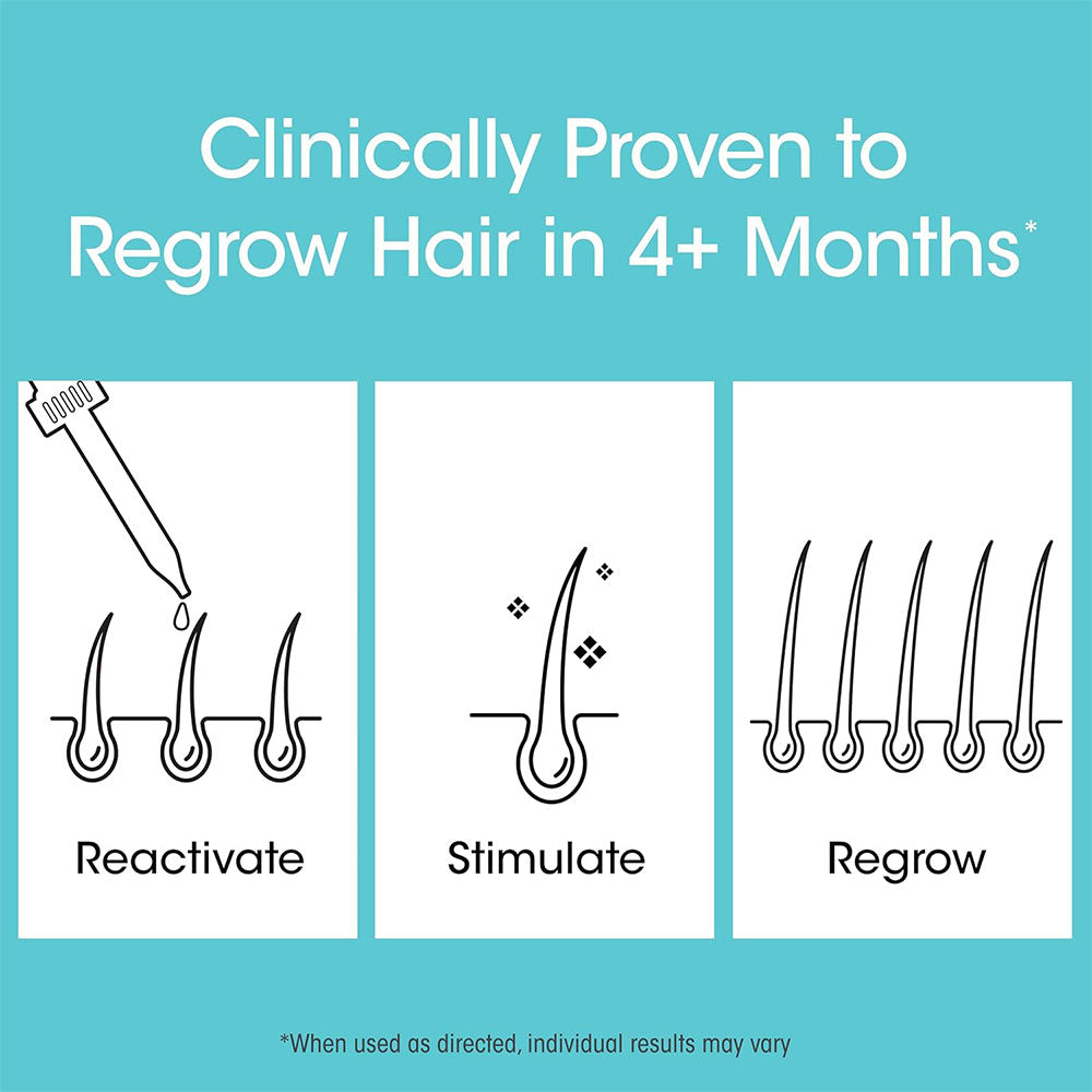 Nutri-Ox Minoxidil Treatment 