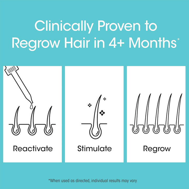 Nutri-Ox Minoxidil Treatment 